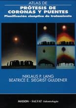 Atlas de prótesis de coronas y puentes | 9788445800805 | Lang, N.P. / Siegrist Guldener, B.E. | Librería Castillón - Comprar libros online Aragón, Barbastro