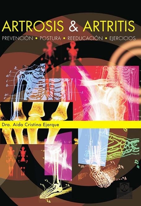 ARTROSIS & ARTRITIS | 9788480190404 | EJARQUE, AIDA CRISTINA | Librería Castillón - Comprar libros online Aragón, Barbastro